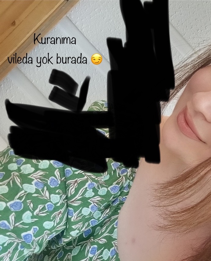 Arkamdaki vileda sapını nasıl yok edebilirim?