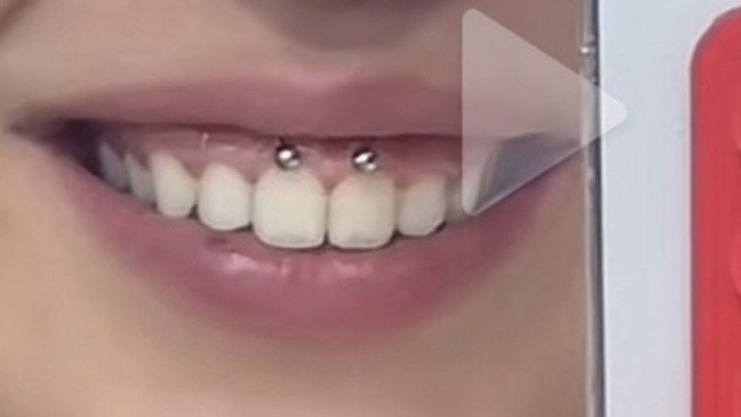 Smiley piercing kullanan var mı?