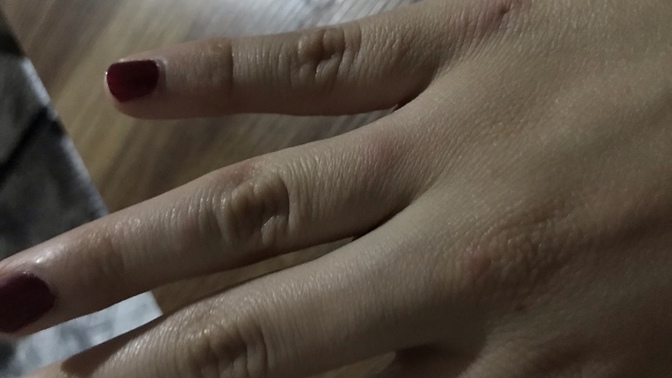 Kuzenimin nisani vardı ortalarda cok dolandım nazar degmis olabilir mi?