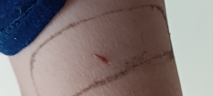 Aceleniz varken ne olursa sinirleriniz iyice hoplar?