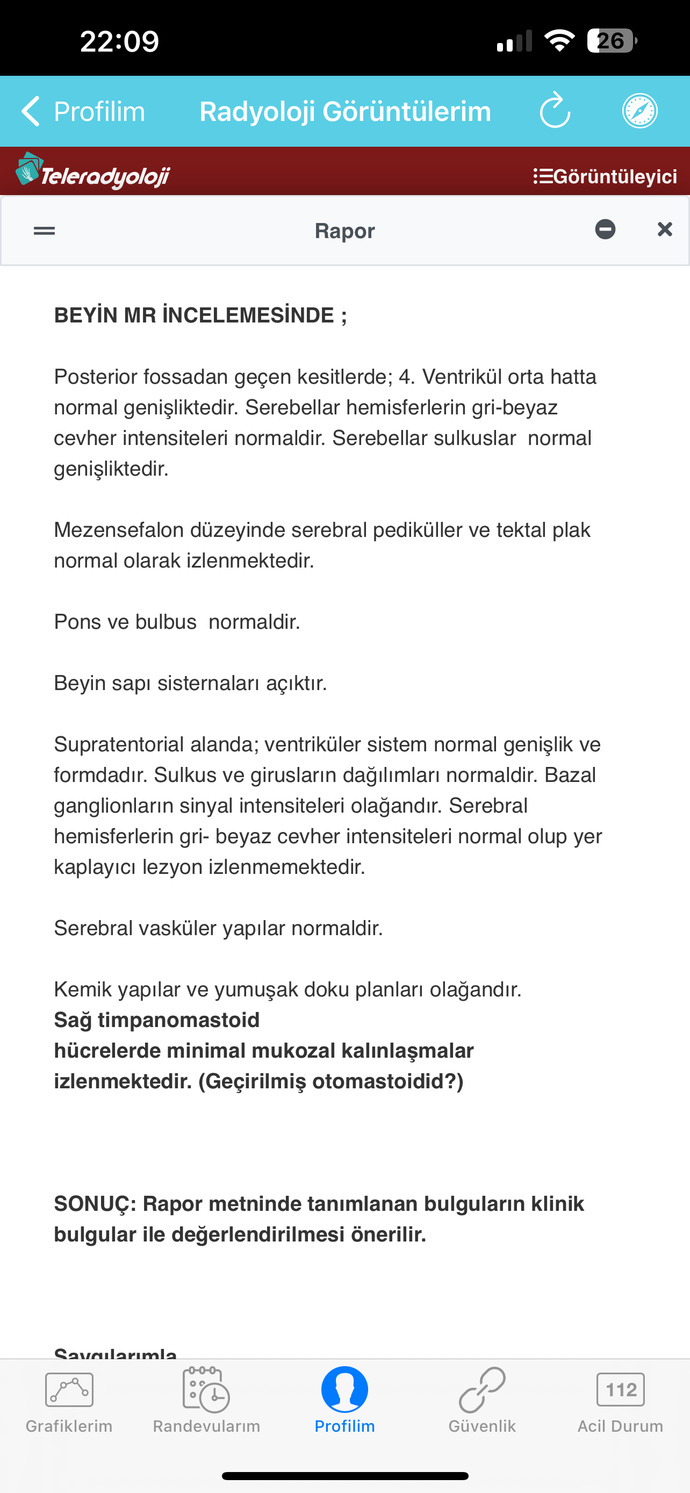 Çok acil anlayan var mı?