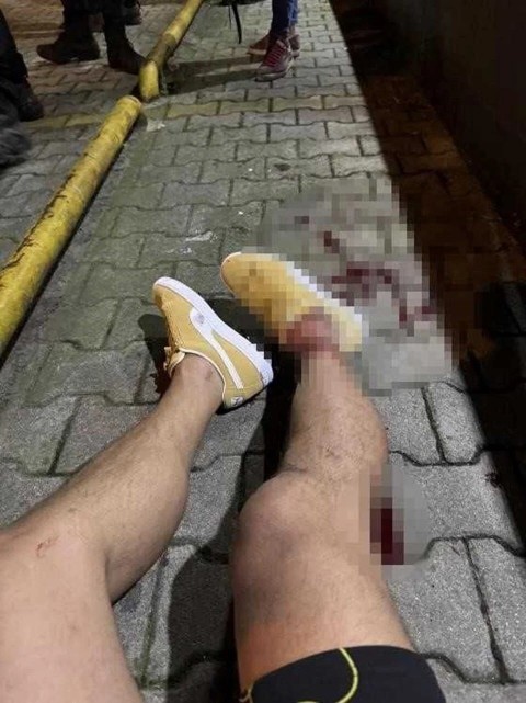 Fenerbahçenin eski futbolcusu şu anda futbol yorumcusu olan Serhat Akın silahlı saldırıya uğradı. Türkiyede Futbol nereye gidiyor?
