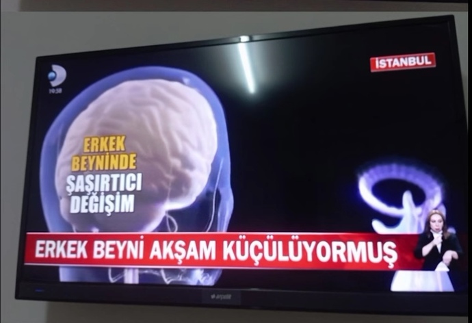 Erkoların beyni akşamları küçülüyormuş neden?