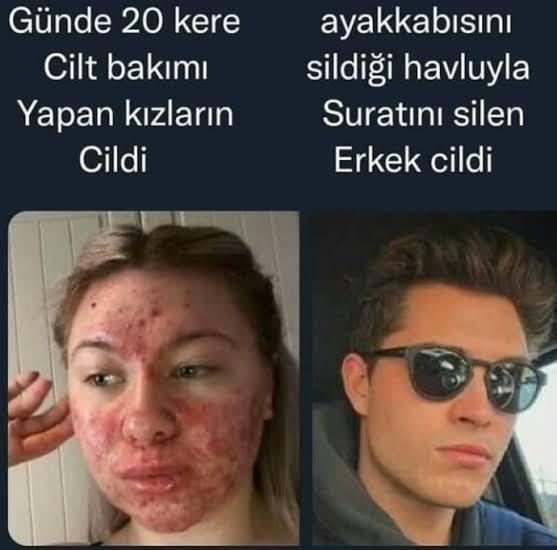 Günde 20 kere cilt bakımı yapsak bile neden erkeklerin cildi kadar güzel olamıyor cildimiz?