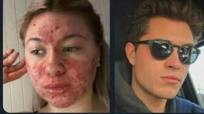 Günde 20 kere cilt bakımı yapsak bile neden erkeklerin cildi kadar güzel olamıyor cildimiz?