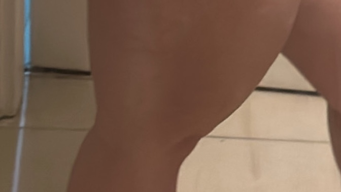 Bacağımın bu biçimde kilolu olması normal mi sizce yoksa bir hastalığım mı var?