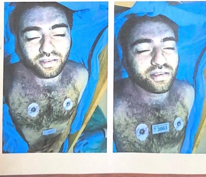 Cem Garipoğlunun mezardan çıkarılan hali sizi hiç şaşırtmıyor mu?