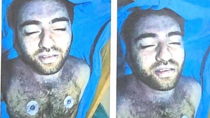 Cem Garipoğlu'nun mezardan çıkarılan hali sizi hiç şaşırtmıyor mu?