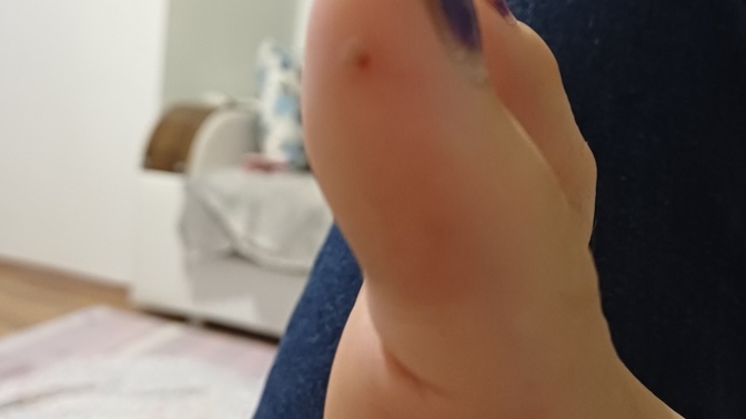 Ayagimda boyle bisi cikti gecmiyor koparmaya calisinca da kaniyor bu neden olur durduk yere cikti?