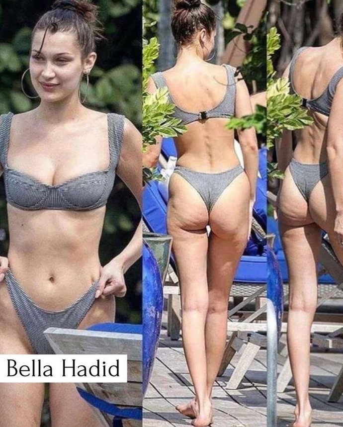 Selüliti kabullensek mi artık?