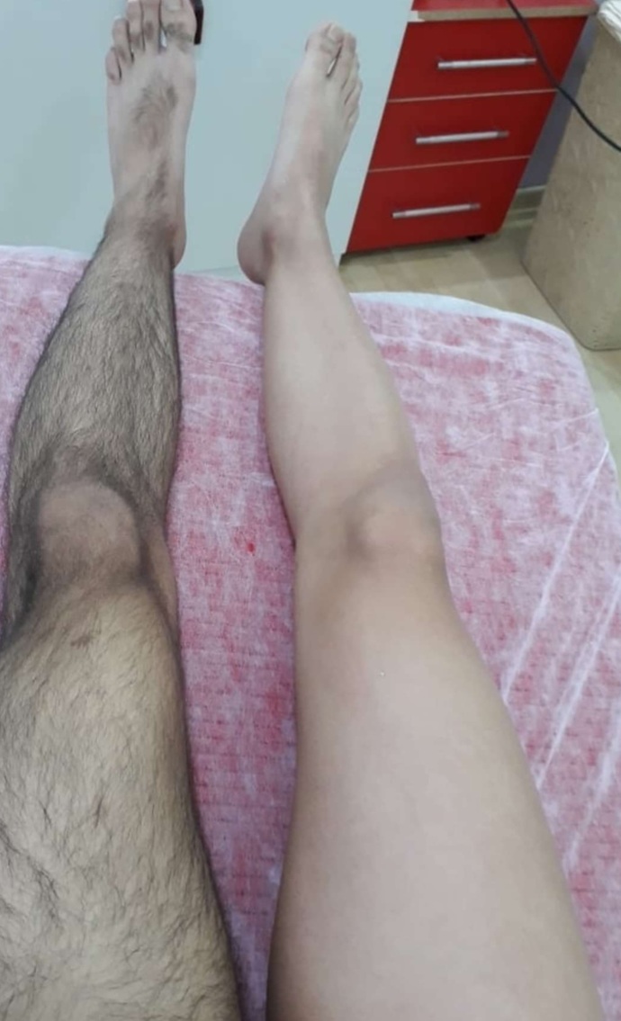 Erkek bacak kıllarını almalı mı?