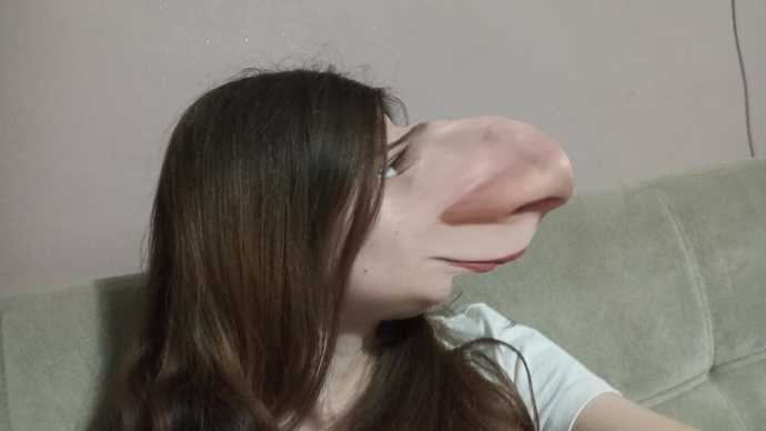Burnumun estetiğe ihtiyacı var mııı?