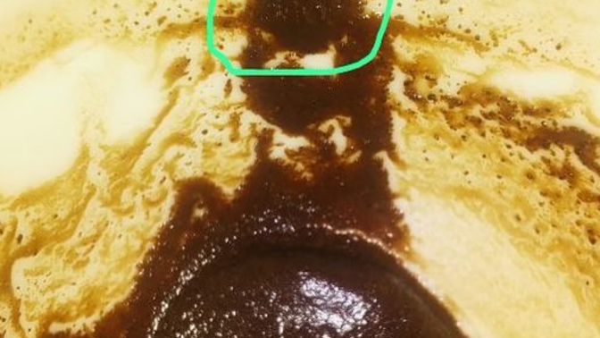 Kalbi görüyor musunuz?
