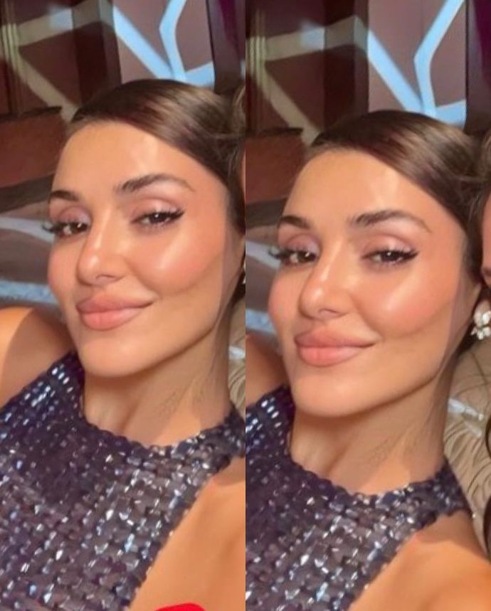 Hande Erçel sizce de estetiği abartmadı mı? Beğenmeyen tek ben miyim?