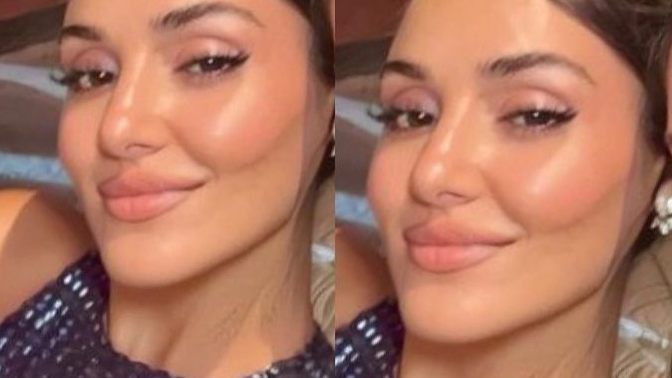 Hande Erçel sizce de estetiği abartmadı mı? Beğenmeyen tek ben miyim?