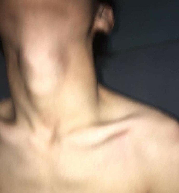 Karşı cinste adem elmasının belirgin olması çekici mi?