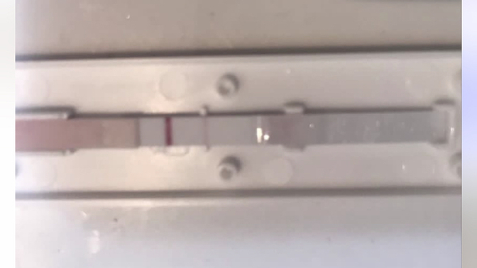 Bu test negatifmi?