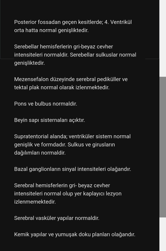 Mr ila ilgili bilgisi olan?