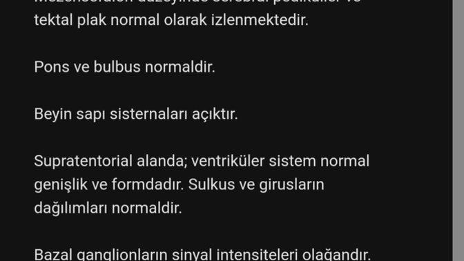 Mr ila ilgili bilgisi olan?