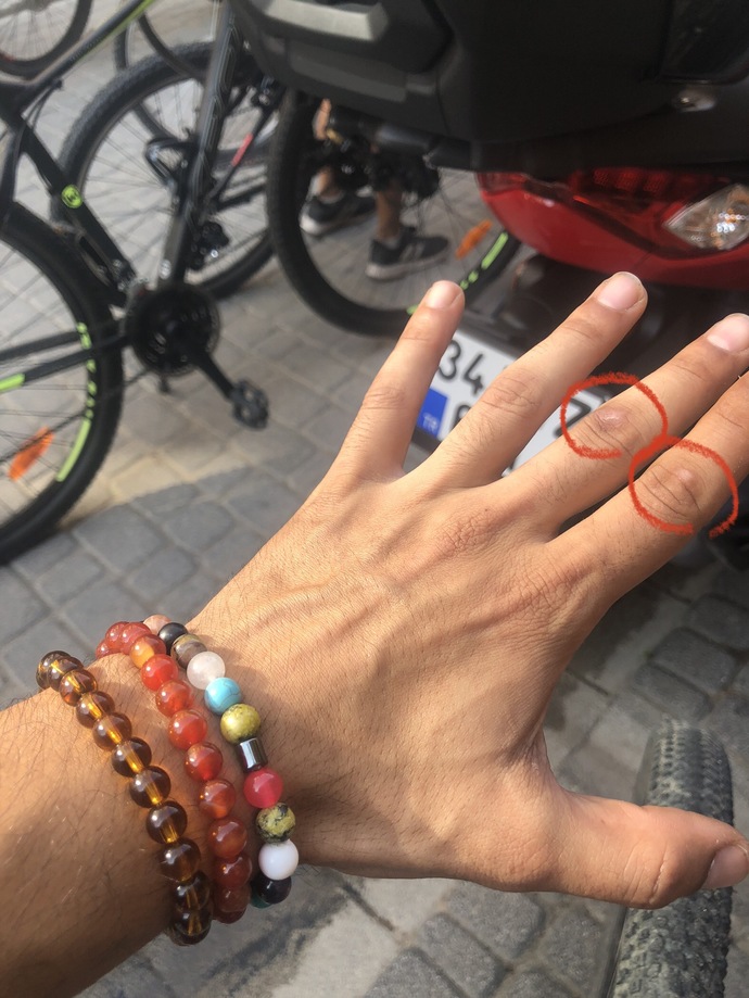Bu yara izleri nasıl geçer?