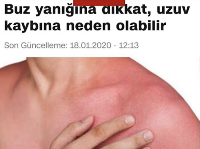 Cilt için sade buz mu yoksa doğal maden suyunun buz hali mi daha etkilidir?