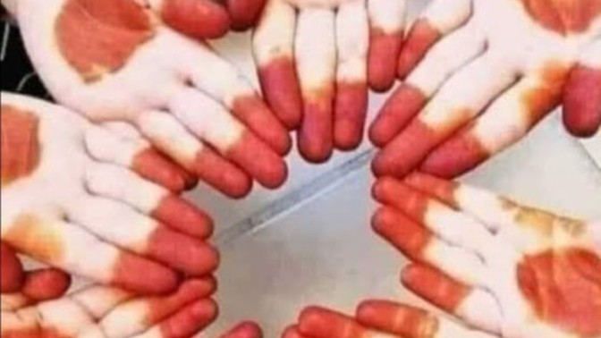 Fobiniz var mı? Varsa nedir?