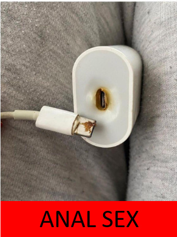 Anal sekse neden bu kadar karşısınız?