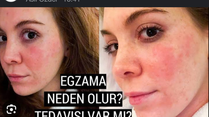 Bende de bundan var nasıl geçecek bu?