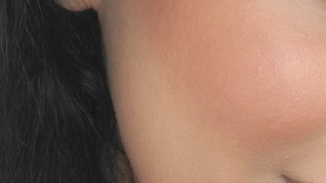 2 gün önceki cildimle şu anki halinin farkına bakar mısınız?
