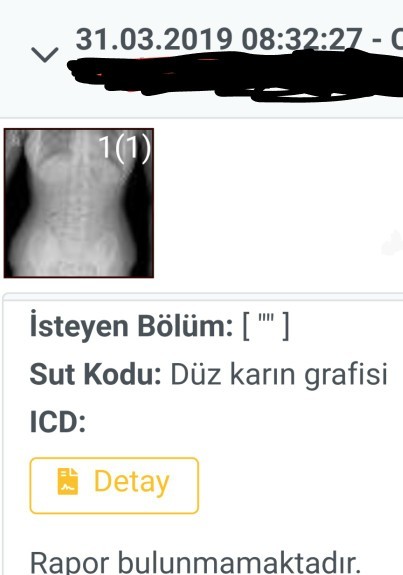 Yıllar öncesinden çektirdiğim röntgende sizce yamukmuyum?