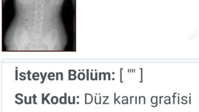 Yıllar öncesinden çektirdiğim röntgende sizce yamukmuyum?