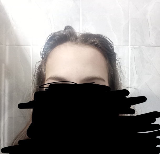 Alnım çok fazla geniş, çözümü nedir?