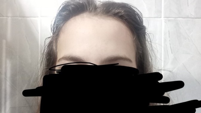 Alnım çok fazla geniş, çözümü nedir?