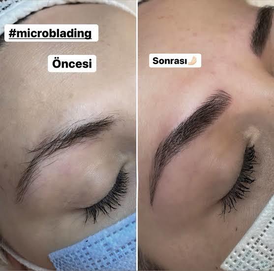 Microblading olan kaşları da küstürür mü?