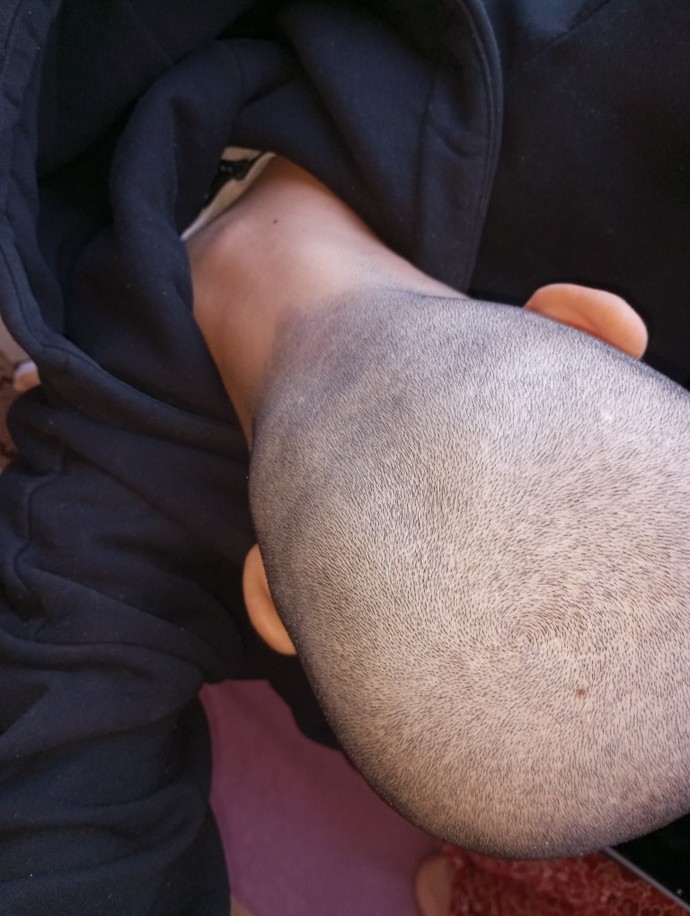 İlk baştaki ilk gün ki diğeri tam 1 hafta sonrası?