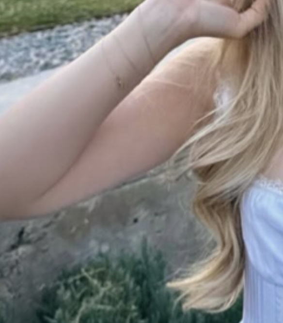 Kollarındaki faça izi mi yoksa saç telleri mi?