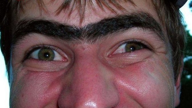 Erkeklerin kaşının ortasını alması normal midir, abes midir?