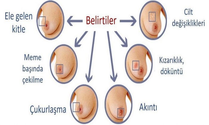 Kanserin erken belirtileri nelerdir?