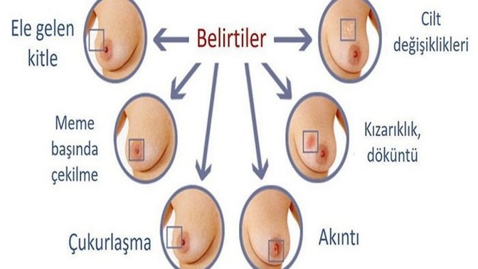 Kanserin erken belirtileri nelerdir?
