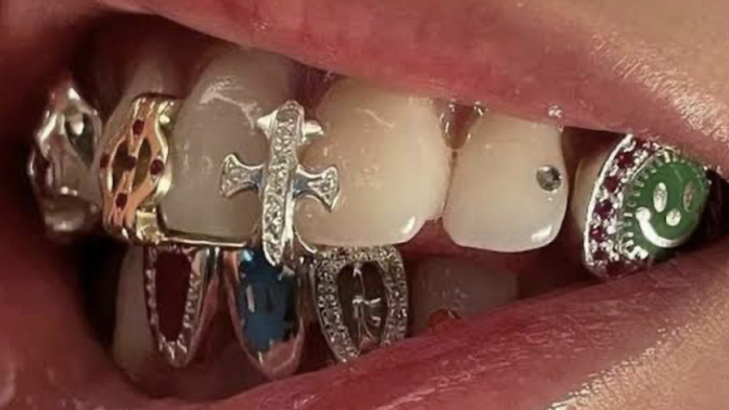 Dişlerinize grillz yaptırmak ister miydiniz?