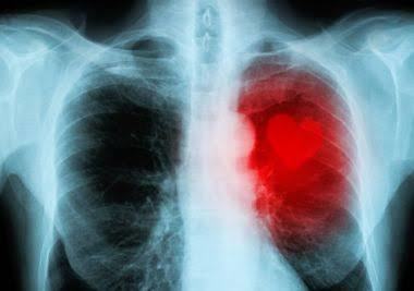Xray cihaziyla gerçek aşkı görebilirmiyiz?