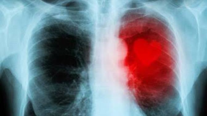 Xray cihaziyla gerçek aşkı görebilirmiyiz?