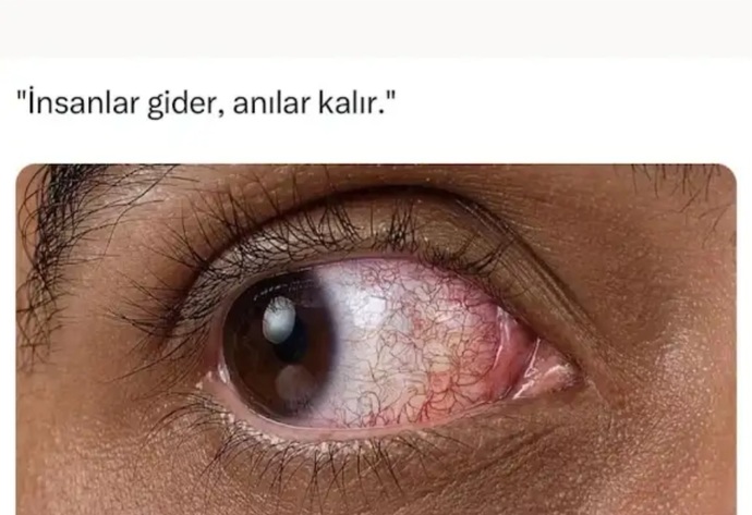 Herkese yürüyen karşı cinsten olur mu?