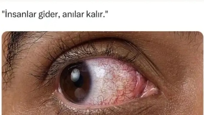 Herkese yürüyen karşı cinsten olur mu?