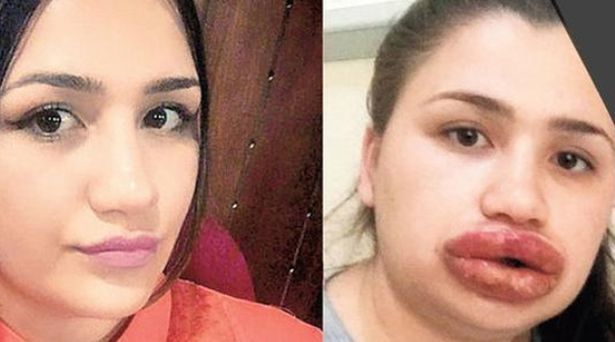 Yıldız dövmem var sizce başka ne yaptırayım?