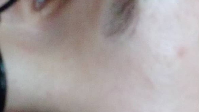Kaşlarımı alan kişi çok inceltti ne yapmalıyım?