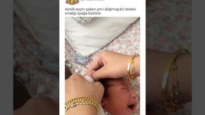 Kendi saçını çeken bebek olur mu?