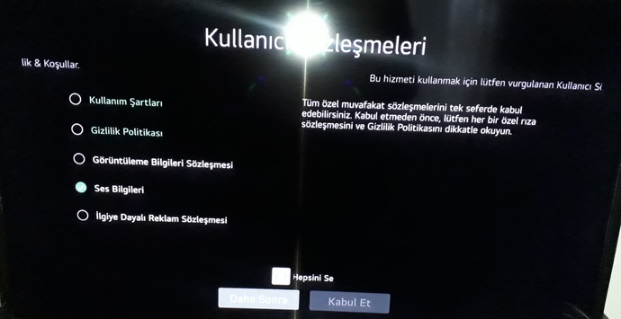 Televizyon ayarlarinda sozlesme maddelerinin hangileri kabul edilir?
