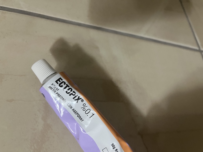 Eczacı bu kremı verdı sıvılcelerım ıcın?