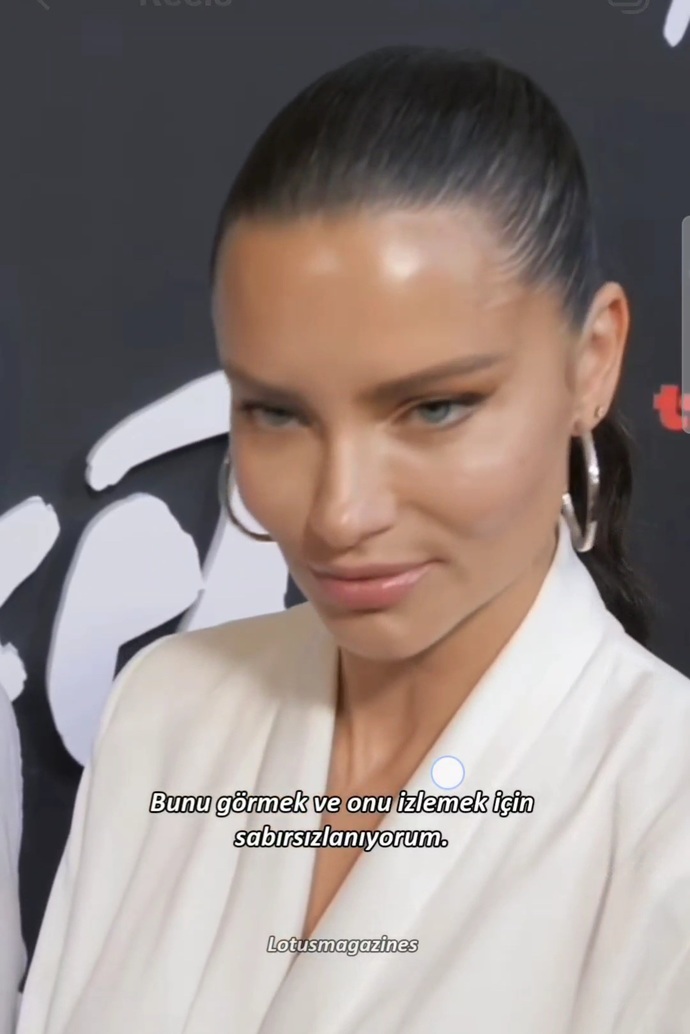 Koskoca Adriana Lima botoks yapmış, yaşlanınca hepimizin kaderi botoks mu?